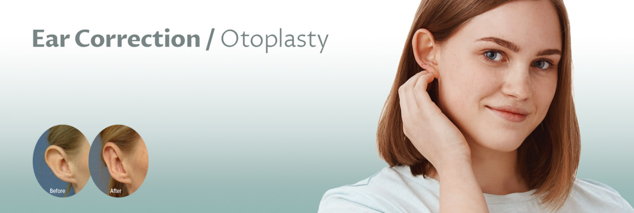 DEFORMED EARS (OTOPLASTY)